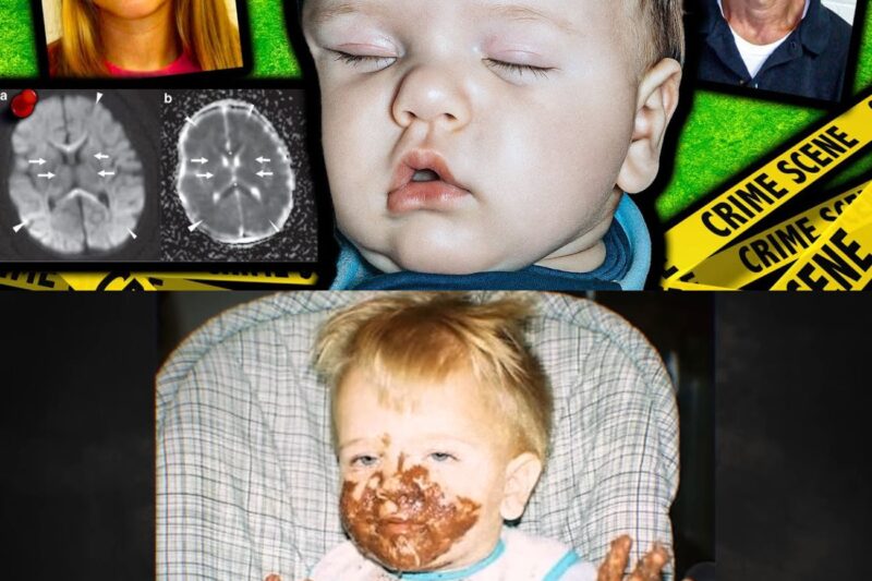 Questo bambino ha riportato 23 delle più gravi lesioni cerebrali mai registrate.