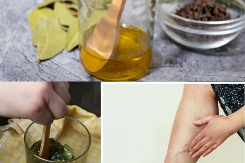 Soffrite di vene varicose? Applicate questa miscela prima di andare a letto: ha solo 4 ingredienti!