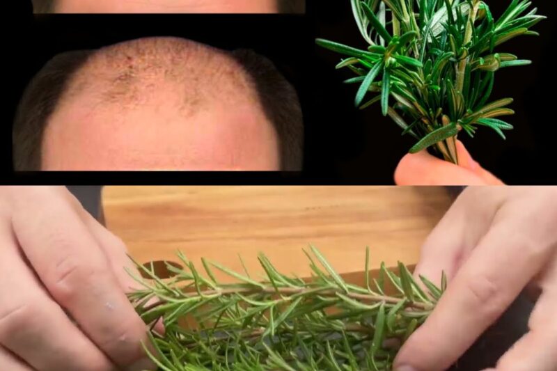 Il Segreto Naturale per una Chioma da Sogno: Come Fermare la Caduta dei Capelli e Stimolarne la Crescita con Soli Due Ingredienti Potenti