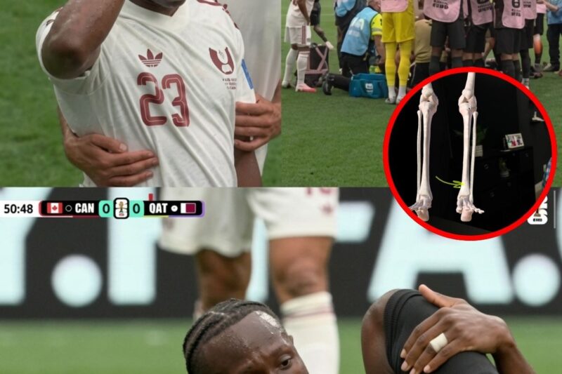 Le cauchemar d’Ismael Kone : Analyse d’une blessure qui a fait trembler le stade