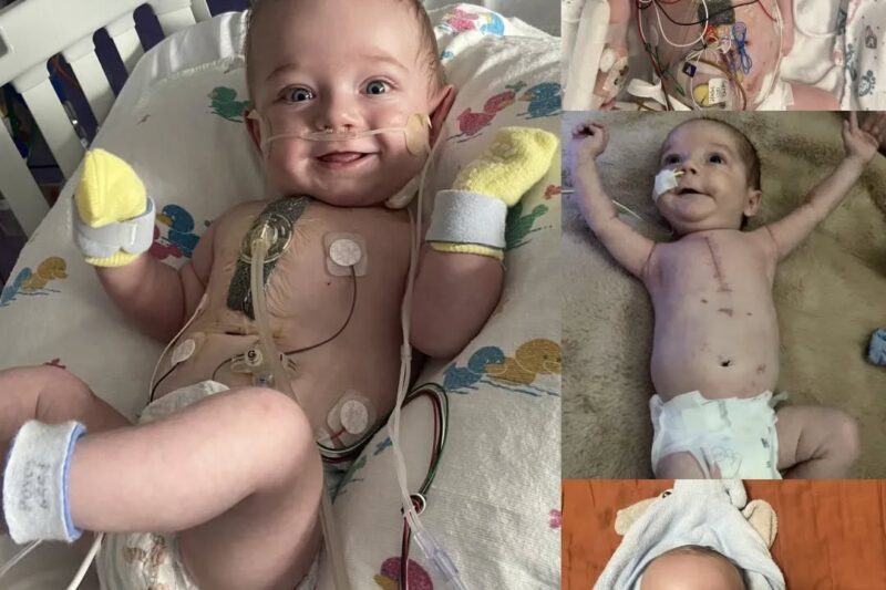 Myles : Le parcours d’un petit guerrier de six mois atteint d’HLHS et d’AVSD