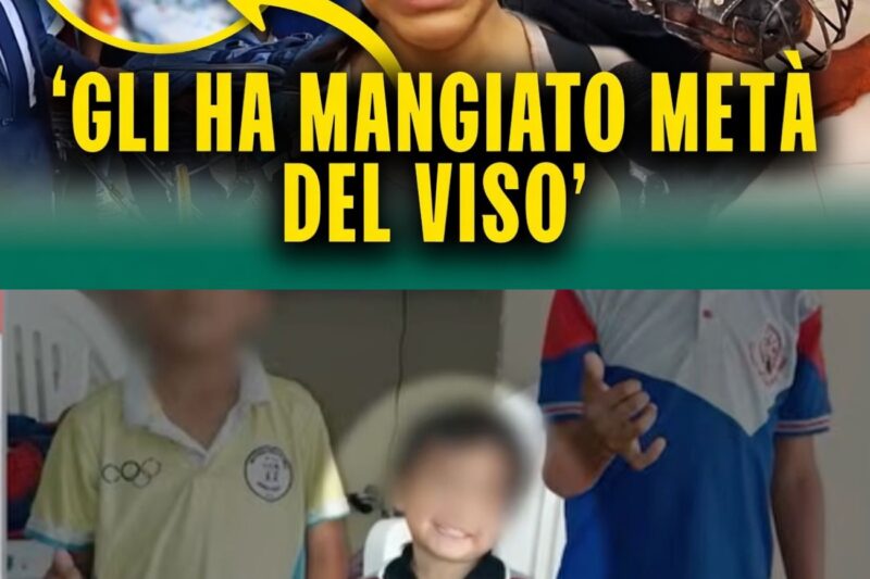 “Danni irreversibili”: un bambino di 4 anni rimane sfigurato e traumatizzato dopo il violento attacco di un cane.