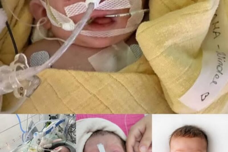 Un miracle miniature : comment une petite fille a survécu au syndrome VACTERL et a enseigné à sa famille le vrai sens de l’espoir.